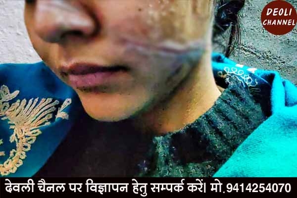 चाइनीज़ मांझा काट रहा है जीवन की डोर, लेकिन प्रशासन है मौन...आखिर क्यों...?